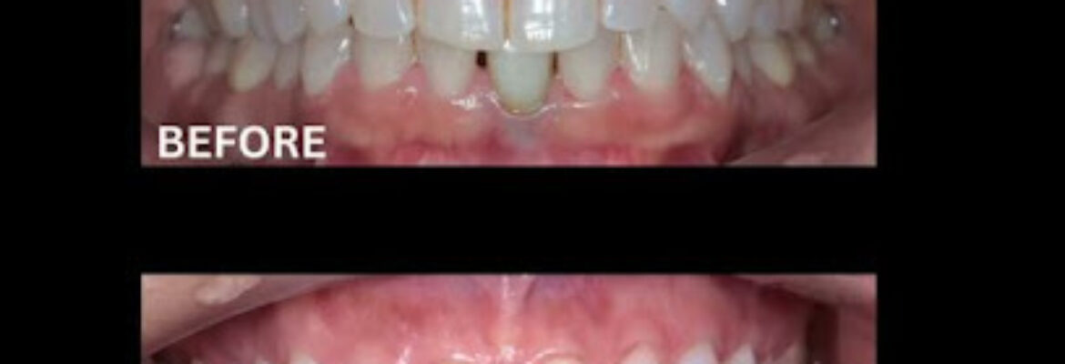 Best Dental Clinic in Pune | Best Dentist in Kasba Peth | Creative Dental Clinic & Implant Centre